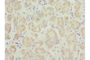 Immunohistochemistry of paraffin-embedded human salivary gland tissue using ABIN7173912 at dilution of 1:100 (TPD52L1 anticorps  (AA 1-144))