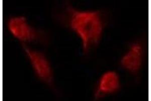 ABIN6275989 staining HUVEC by IF/ICC. (FSHR anticorps  (Internal Region))