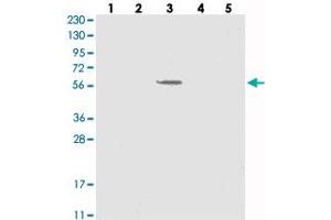 Western blot analysis of Lane 1: RT-4, Lane 2: U-251 MG, Lane 3: Human Plasma, Lane 4: Liver, Lane 5: Tonsil with SLC43A3 polyclonal antibody . (SLC43A3 anticorps)