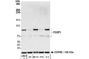 Western Blotting (WB) image for anti-Forkhead Box P1 (FOXP1) (AA 627-677) antibody (ABIN7454010)