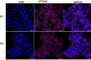 anti-Spectrin alpha Chain, Brain (SPTAN1) antibody