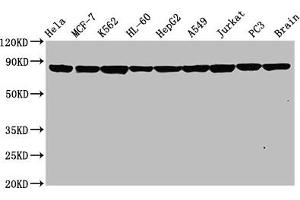 Western Blot Positive WB detected in: Hela whole cell lysate, MCF-7 whole cell lysate, K562 whole cell lysate, HL-60 whole cell lysate, HepG2 whole cell lysate, A549 whole cell lysate, Jurkat whole cell lysate, PC3 whole cell lysate, Rat brain tissue All lanes: Hsp90 alpha antibody at 0.