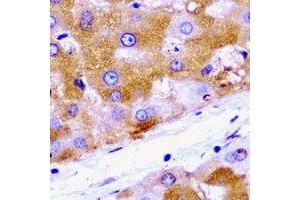 Immunohistochemical analysis of HADH staining in rat liver  formalin fixed paraffin embedded tissue section. (HADH anticorps)