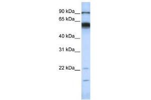MMP16 antibody used at 1 ug/ml to detect target protein.