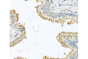 Immunohistochemistry of paraffin-embedded Human prostate using RNASE13 Polyclonal Antibody at dilution of 1:100 (40x lens). (RNASE13 anticorps)