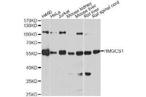 Western blot analysis of extracts of various cell lines, using HMGCS1 antibody. (HMGCS1 anticorps  (AA 241-520))