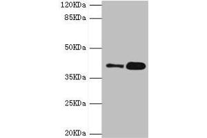 GDAP1 anticorps  (AA 1-225)