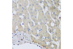 Immunohistochemistry of paraffin-embedded human liver injury using NSF antibody. (NSF anticorps)