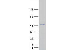 Validation with Western Blot