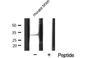 estern blot analysis of Cyclin D1 expression in mouse brain tissue lysates,The lane on the right is treated with the antigen-specific peptide. (Cyclin D1 anticorps  (C-Term))