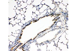 Anti-FGFR3 antibody, IHC(P) IHC(P): Rat Lung Tissue (FGFR3 anticorps  (N-Term))