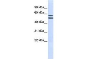 Image no. 1 for anti-Phosphatidylinositol Glycan Anchor Biosynthesis, Class Q (PIGQ) (AA 144-193) antibody (ABIN6740970) (PIGQ anticorps  (AA 144-193))