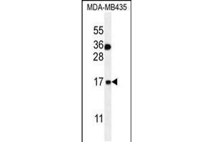 Western blot analysis in MDA-MB435 cell line lysates (35ug/lane). (S100A1 anticorps  (C-Term))