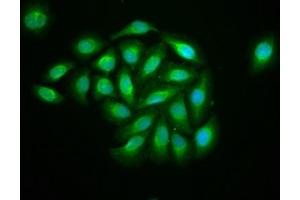 anti-Kinesin Family Member 13B (KIF13B) (AA 1531-1701) antibody