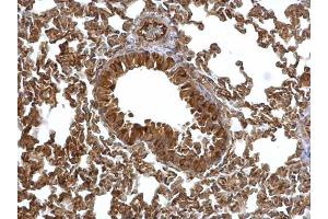 IHC-P Image EML1 antibody [C3], C-term detects EML1 protein at cytosol on mouse lung by immunohistochemical analysis. (EML1 anticorps  (C-Term))