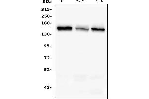 Western blot analysis of RAB3GAP2 using anti-RAB3GAP2 antibody (ABIN6719633). (RAB3GAP2 anticorps  (AA 1-115))