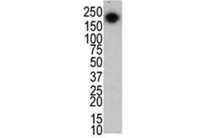 The LRRK2 antibody used in western blot to detect LRRK2/PARK8 in mouse brain cell lysate (LRRK2 anticorps  (C-Term))
