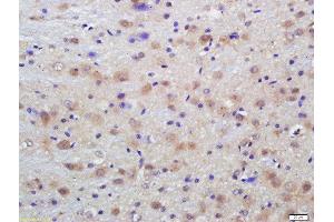 Formalin-fixed and paraffin embedded rat brain labeled with Anti-Phospho-Dab1 (Tyr198)Polyclonal Antibody, Unconjugated  at 1:200 followed by conjugation to the secondary antibody and DAB staining (DAB1 anticorps  (pTyr198))