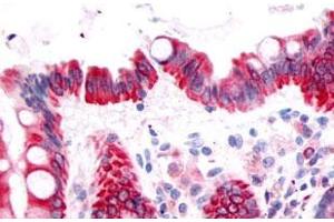 Immunohistochemical (Formalin/PFA-fixed paraffin-embedded sections) staining in human colon, epithelium with PTGDR polyclonal antibody . (PTGDR anticorps  (3rd Extracellular Domain))