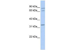GJA4 antibody used at 1 ug/ml to detect target protein. (GJA4 anticorps  (Middle Region))