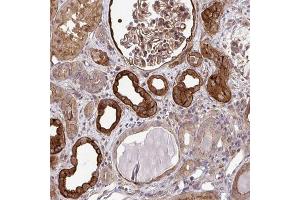 Immunohistochemical staining of human kidney with TRIP6 polyclonal antibody  shows strong cytoplasmic and membranous positivity in cells in tubules and cells in glomeruli at 1:50-1:200 dilution. (TRIP6 anticorps)