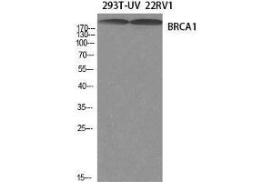 Western Blot analysis of 293T-UV, 22RV1 cells using BRCA1 Polyclonal Antibody at dilution of 1:1000. (BRCA1 anticorps)