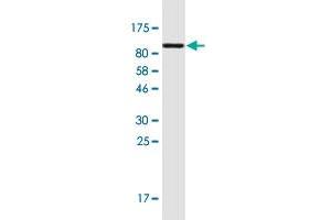 Western Blot detection against Immunogen (94. (Plastin 3 anticorps  (AA 1-630))