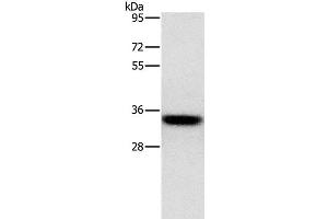 Western Blot analysis of PC3 cell using HOXB13 Polyclonal Antibody at dilution of 1:800 (HOXB13 anticorps)