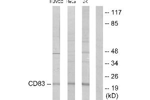 Immunohistochemistry analysis of paraffin-embedded human lung carcinoma tissue using CD83 antibody. (CD83 anticorps)