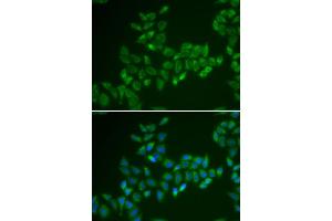 Immunofluorescence analysis of HeLa cells using CRAT antibody (ABIN5973772). (CRAT anticorps)