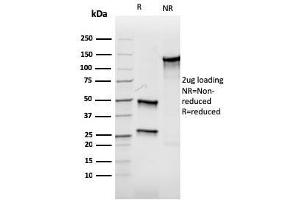 anti-Aurora Kinase B (AURKB) (AA 89-251) antibody