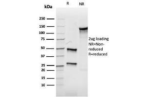 SDS-PAGE Analysis Purified Aurora B Recombinant Mouse Monoclonal Antibody (rAURKB/1592). (Recombinant Aurora Kinase B anticorps  (AA 89-251))