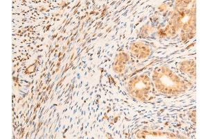 ABIN6267218 at 1/100 staining rat uterine tissue sections by IHC-P. (SGK1 anticorps  (pSer422))
