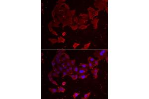 Immunofluorescence analysis of A549 cells using FLCN antibody (ABIN5973885). (FLCN anticorps)