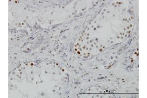 Immunoperoxidase of monoclonal antibody to BRD3 on formalin-fixed paraffin-embedded human testis.
