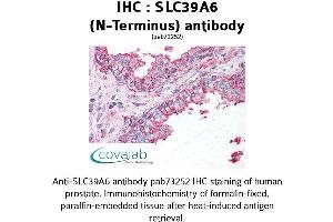 Image no. 2 for anti-Solute Carrier Family 39 (Zinc Transporter), Member 6 (SLC39A6) (N-Term) antibody (ABIN1739378)