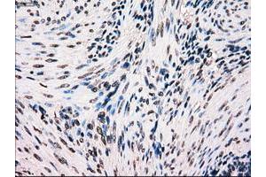 Image no. 5 for anti-B-Raf proto-oncogene, serine/threonine kinase (BRAF) antibody (ABIN1496951)
