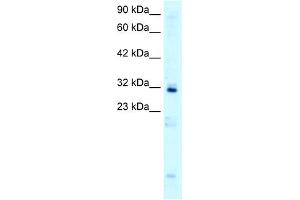 WB Suggested Anti-HOXB9 Antibody Titration:  0. (HOXB9 anticorps  (N-Term))