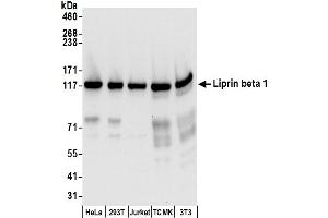 Western Blotting (WB) image for anti-PTPRF Interacting Protein, Binding Protein 1 (Liprin beta 1) (PPFIBP1) (AA 175-225) antibody (ABIN7450418)