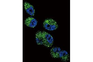 Confocal immunofluorescent analysis of CYP4A11 (4A22) Antibody with NCI-H460 cell followed by Alexa Fluor 488-conjugated goat anti-rabbit lgG (green).