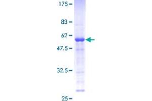 Image no. 1 for Male Enhanced Antigen 1 (MEA1) (AA 1-185) protein (GST tag) (ABIN1310616)