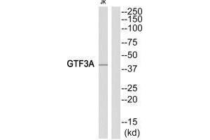 Western blot analysis of extracts from Jurkat cells, using GTF3A antibody. (GTF3A anticorps)