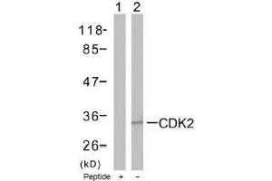Image no. 1 for anti-Cyclin-Dependent Kinase 2 (CDK2) (Thr160) antibody (ABIN197287) (CDK2 anticorps  (Thr160))