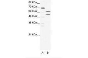Image no. 1 for anti-Zinc Finger and BTB Domain Containing 43 (ZBTB43) (AA 151-200) antibody (ABIN202596) (ZBTB43 anticorps  (AA 151-200))