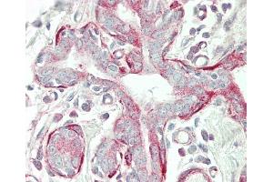 Formalin-fixed and paraffin-embedded H.