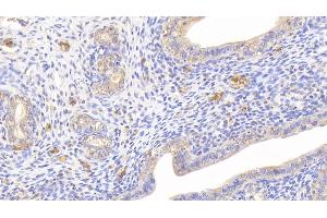 Detection of HB in Rat Uterus Tissue using Polyclonal Antibody to Hemoglobin (HB) (Hemoglobin anticorps)