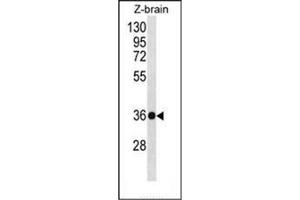 Western blot analysis of HOXD10 Antibody (C-term) in Zebrafish brain tissue lysates (35ug/lane).
