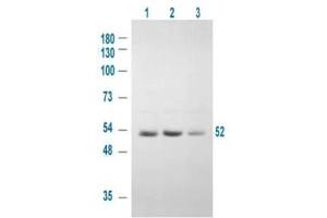 Western blot using  Affinity Purified anti-GSK3A antibody shows detection of a 52 kDa band corresponding to human GSK3A in various human derived 293T cell extracts.
