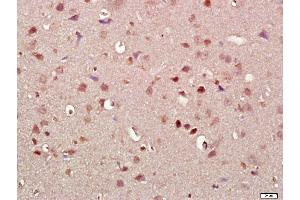 Paraformaldehyde-fixed, paraffin embedded rat brain, Antigen retrieval by boiling in sodium citrate buffer (pH6. (SNCA anticorps  (AA 51-90))