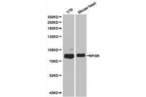 Western Blotting (WB) image for anti-Retinitis Pigmentosa GTPase Regulator (RPGR) antibody (ABIN1874639) (RPGR anticorps)